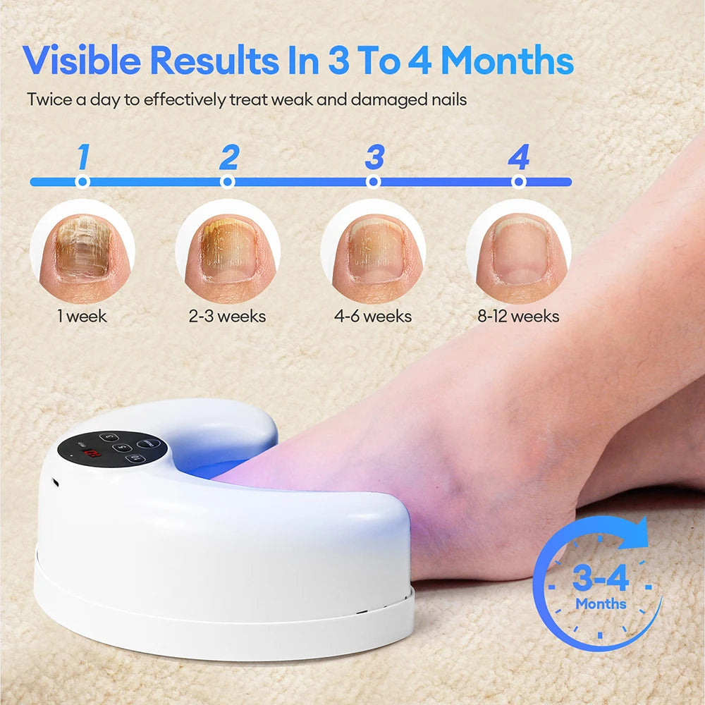 Revolutionary Wireless Toenail Fungus Treatment Lamp - Infrared & Blue Light Laser Device for Effective Nail Health