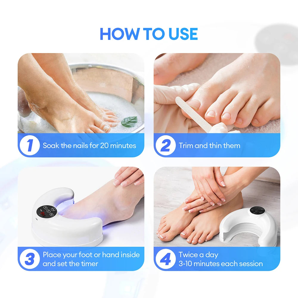 Revolutionary Wireless Toenail Fungus Treatment Lamp - Infrared & Blue Light Laser Device for Effective Nail Health